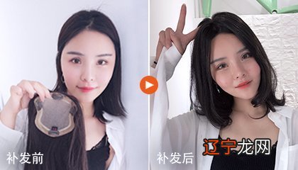 女人发际线高有什么说法？已解答