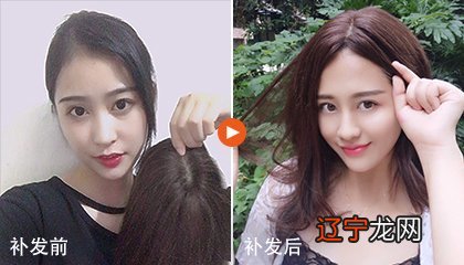 女人发际线高有什么说法？已解答