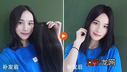 女人发际线高有什么说法？已解答