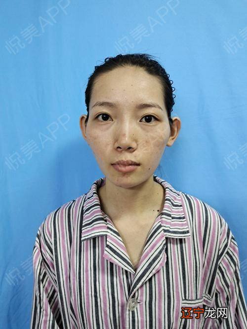 女人颧骨高真的克夫吗_女人颧骨高真的克夫吗?_颧骨高克夫