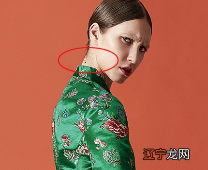 人脖子后面槽头肉_脖子后面长癣有偏方吗_脖子后面有痣的人