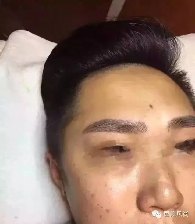 眉毛看几岁的运势_男人眉毛运势解析图解_眉毛有疤痕影响运势吗