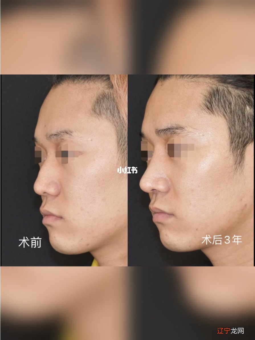 男人鼻子看运势