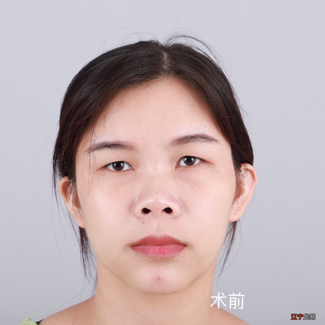 看女面相痣算命图解_看眼睛算命眼睛面相运势图_面相看中年运势