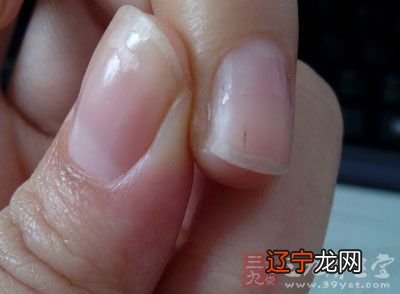 算命看指甲_如何看指甲看健康_指甲盖看运势