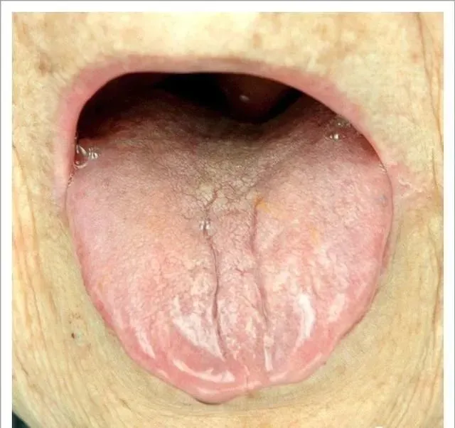 舌尖上的中国中医几千年研究员、主任医师气色,你知道吗?