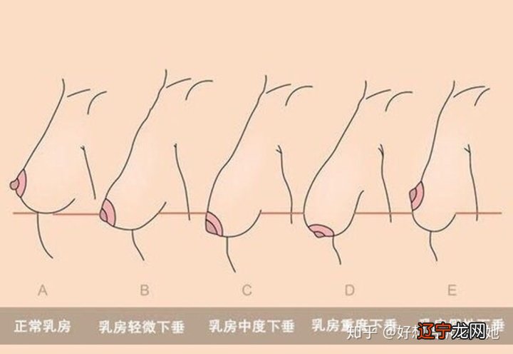 如何丰胸最有效 亦姿佳自然丰胸_丰胸网自体脂肪丰胸_自己梦见丰胸